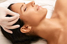 Acupuntura Facial